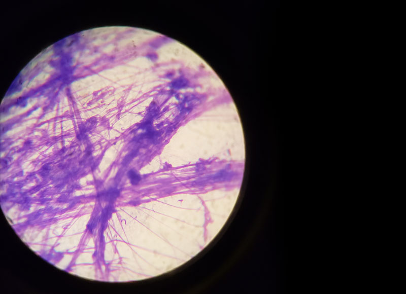 A microscopic view of purple stained fibrous structures on a light background, reminiscent of what a veterinarian might observe through a circular microscope lens. The fibers display varying thicknesses and arrangements, creating an intricate pattern against the contrasting black perimeter.
