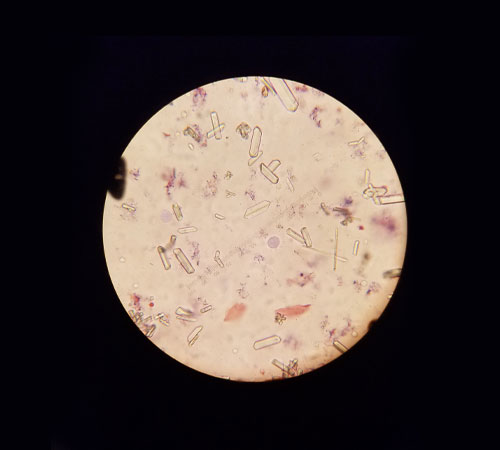 An image of a microscope slide under low magnification displays various small, elongated, and irregularly shaped crystals on a light background. The slide also shows scattered pink and purple stains, indicating biological materials often seen in veterinary studies.